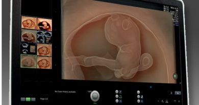 image from 3d ultrasound machine