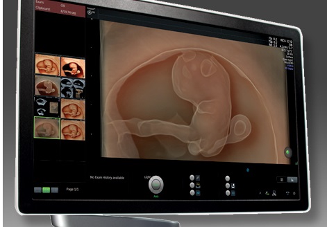 image from 3d ultrasound machine