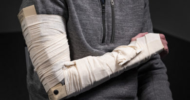 Alphapointe to produce military splint Alphapointe to produce military splint
